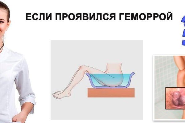 Кракен маркетплейс ассортимент