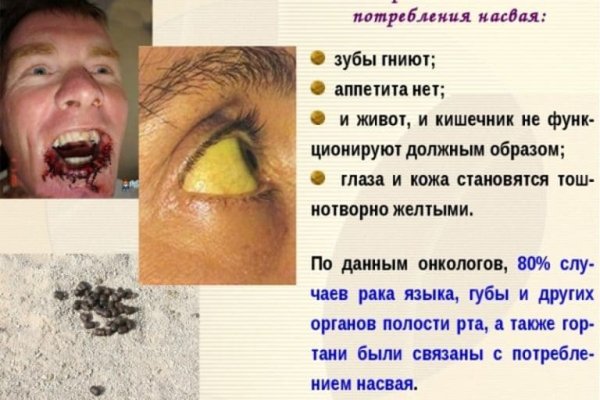 Клирнет ссылка на зеркало маркетплейс кракен